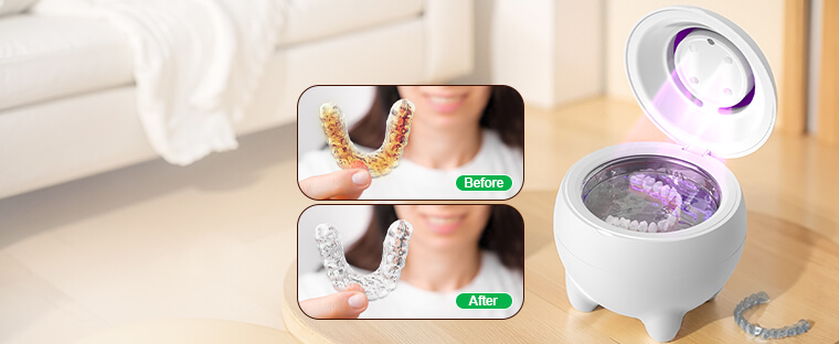 Dentures and braces ultrasonic cleaning machine